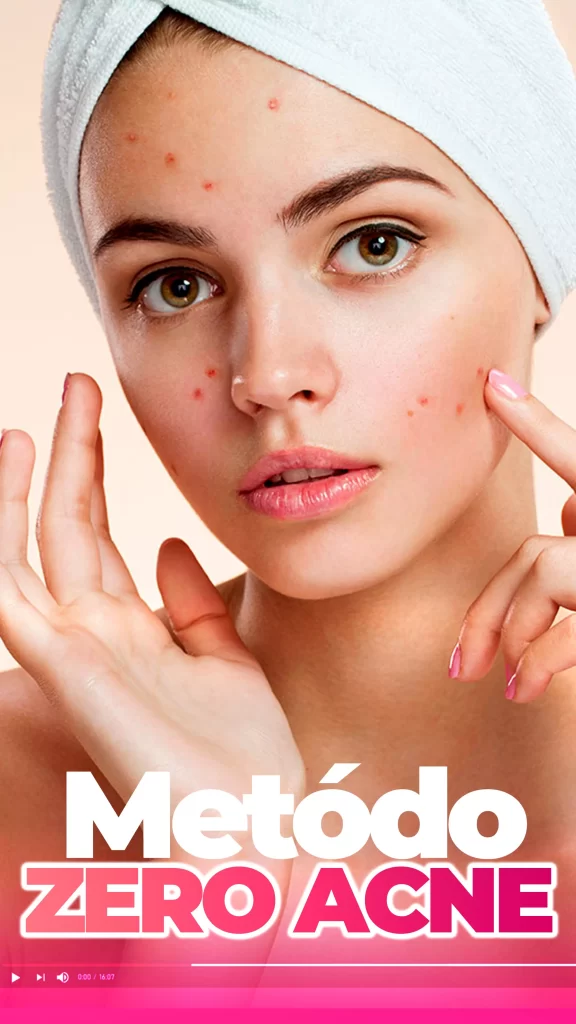 zero-acne-576x1024-1
